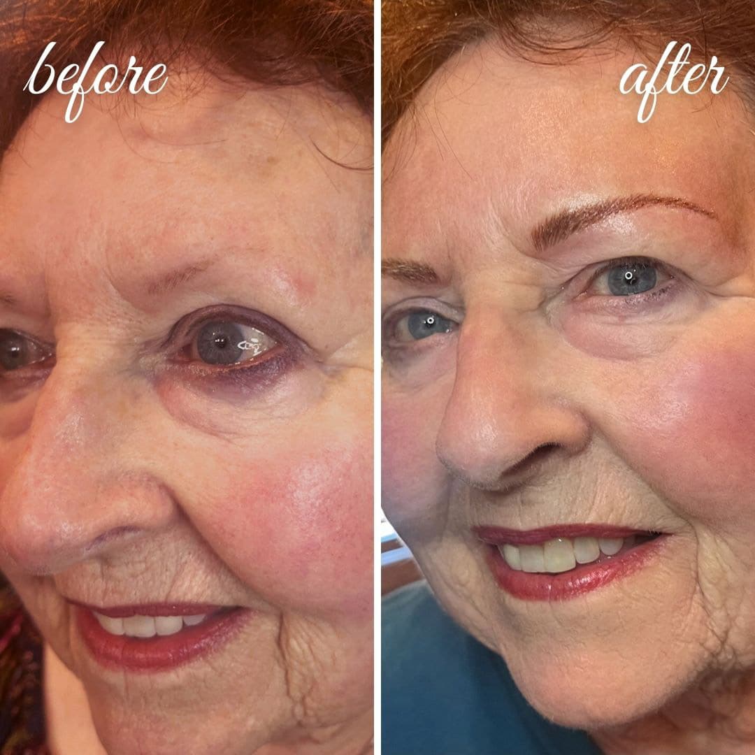 vertical before/after - 1